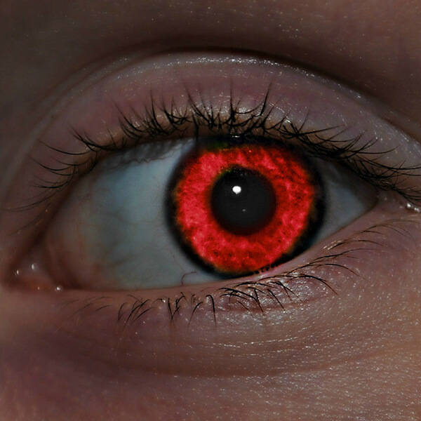 Red-Eye Removal